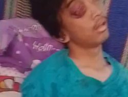 DERITA WARGA CIREBON BUTUH ULURAN TANGAN, JALANI PENGOBATAN DAN DIRUJUK KE BANDUNG
